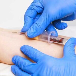 Venepuncture Practices & Techniques