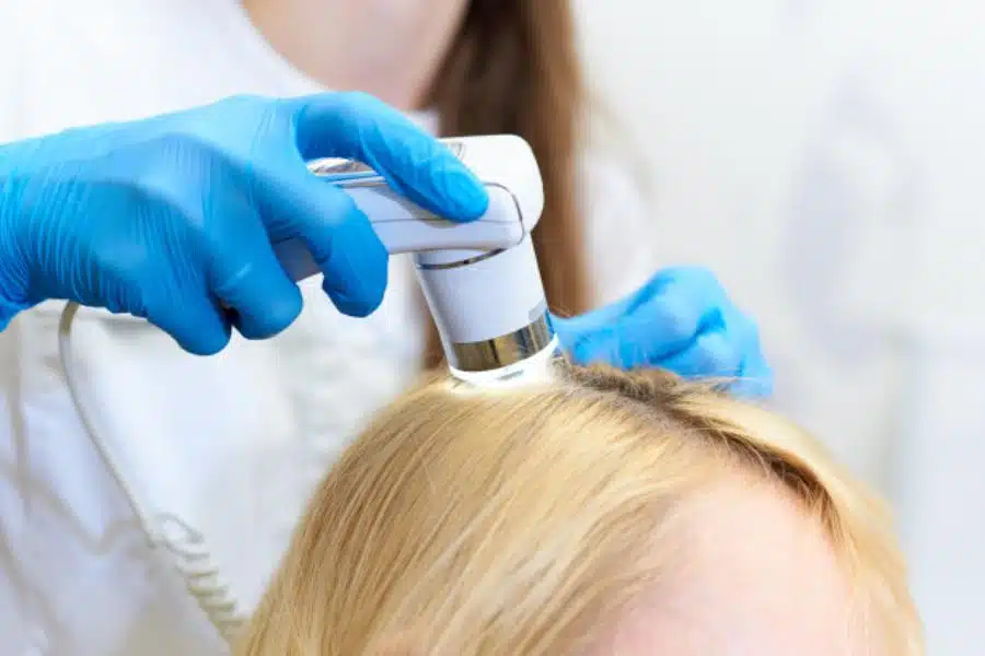 Hair Loss Consultations