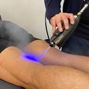 Localized Cryotherapy